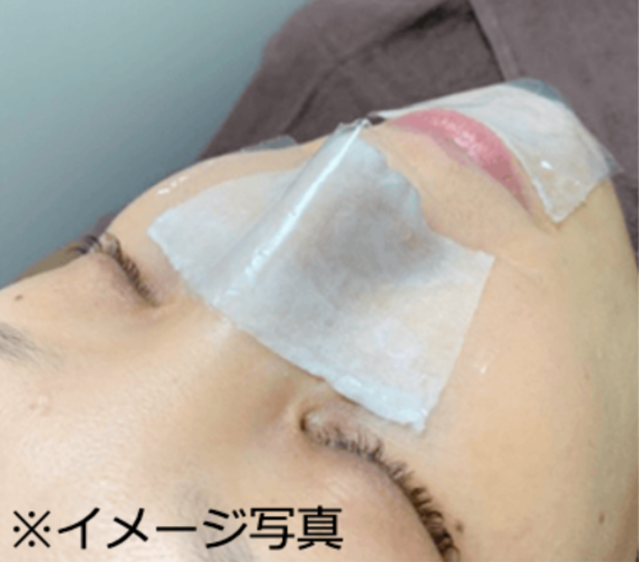 当院ではすべての患者様に角栓軟化剤を使用！