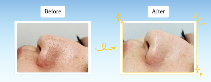 ハイドラジェントル